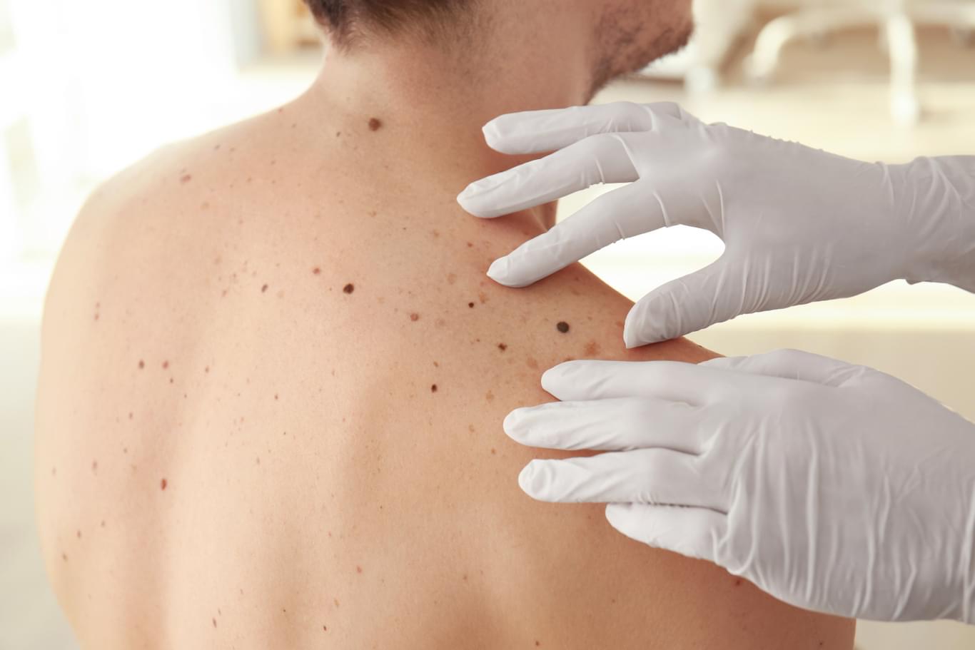 konferencja dermatologia